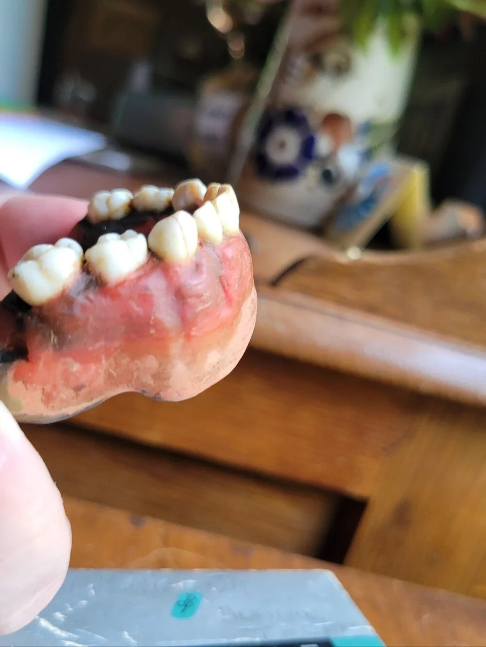 vintage Bakelite Dental Products